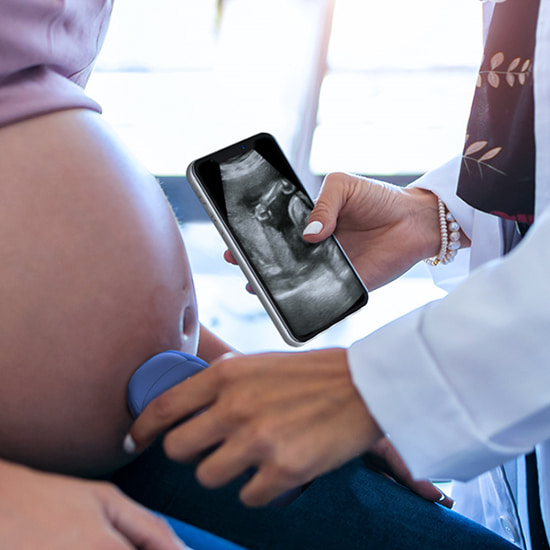 128-element ultrasound transducer