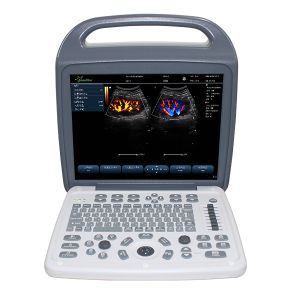 15-Inch High Resolution LED Laptop Color Doppler Ultrasound Machine Storage 500G