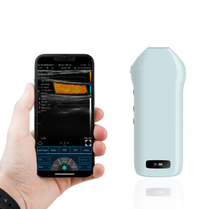 192 Elements 10-14Mhz Linear Color Doppler Pocket Ultrasound Scanners