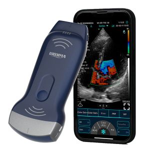 128 Elements Dual-Probes Whole Body Portable Ultrasound Scanner