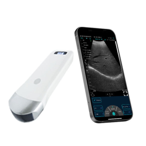 80 Elements Convex3.5Mhz Abdomen Ultrasound Scanner