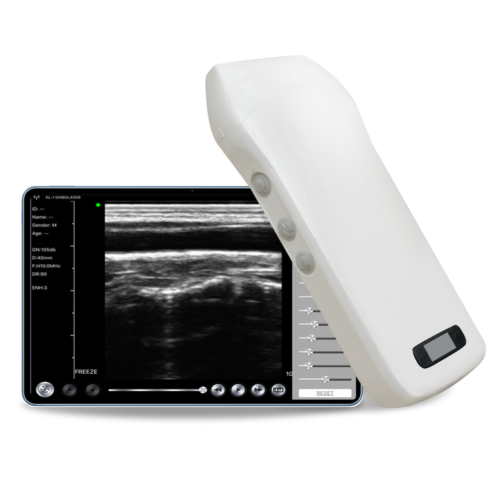 128 Elements 7.5-10Mhz B&W Linear Probe Portable Ultrasound Scanners