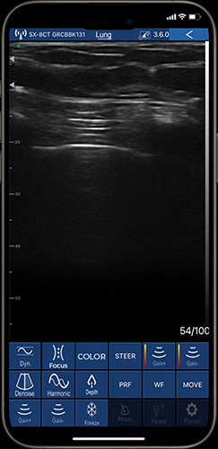 chest and lung examinations on phone with primary care ultrasound