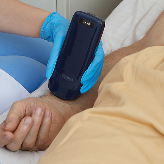 handheld linear probe ultrasound device