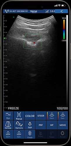 soft tissue examination on phone with primary care ultrasound