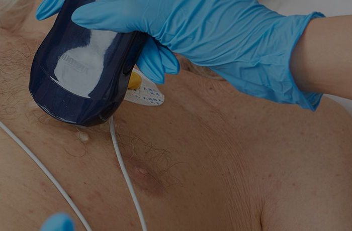 Ultrasound Revolution for Emergency Care