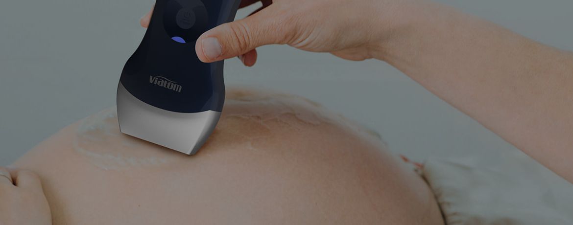 Ultrasound device with 128 elements