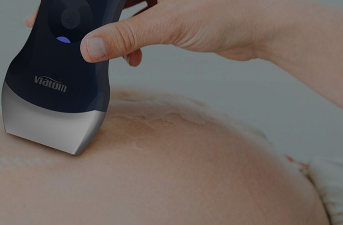 Ultrasound device with 128 elements