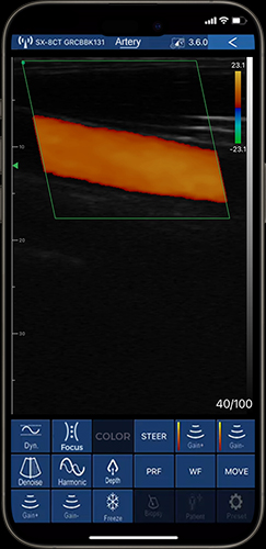 vascular assessments on phone with primary care ultrasound