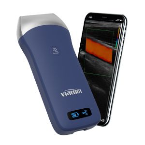 128 elements 7.5/10MHz Linear Probe Color Ultrasound Scanner