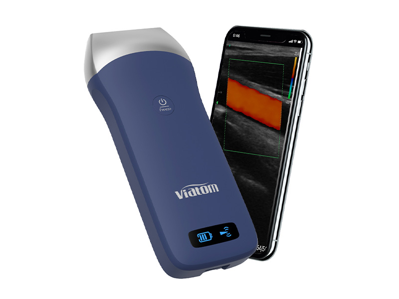 128 elements 7.5/10MHz Linear Probe Color Ultrasound Scanner