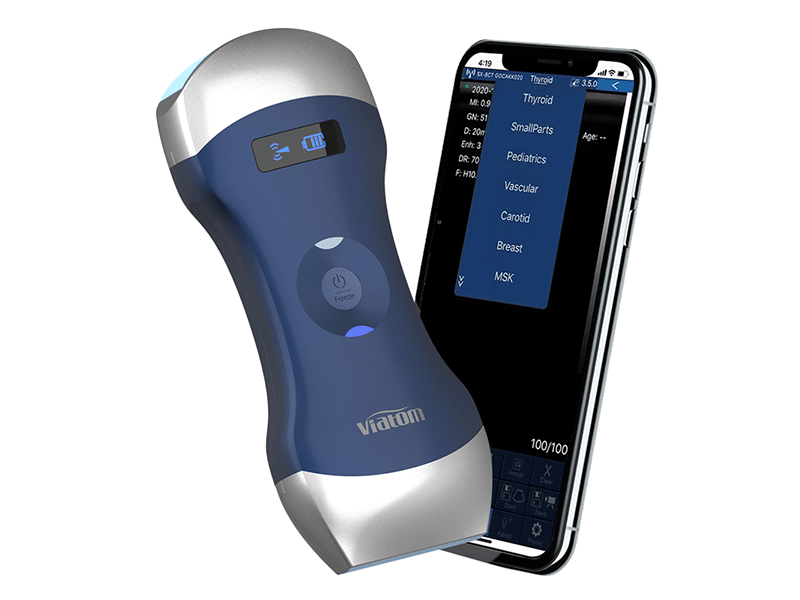 128-Element Dual Probes Multipurpose Handheld Ultrasound Scanner