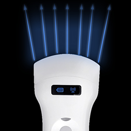curved array ultrasound