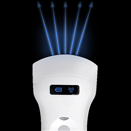 phased array ultrasound