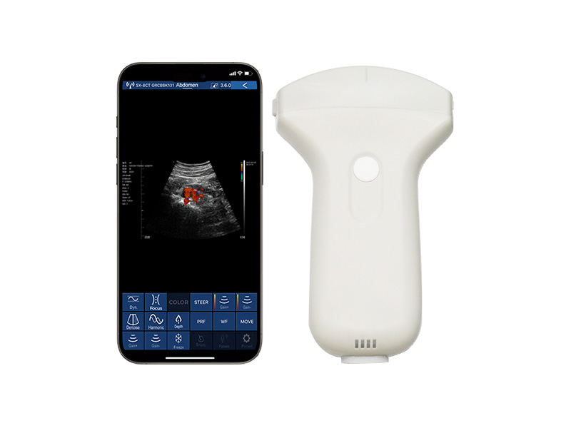 80 Elements 3.2/5.0MHz Convex Probe Color Handheld Ultrasound