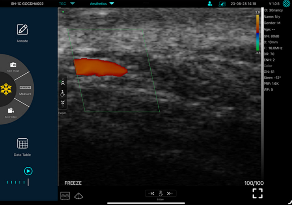pic of ultrasound for Aesthetic