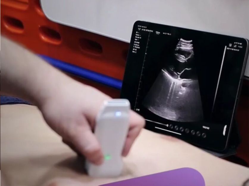 wireless-ultrasound-probe-used-in-cardiology