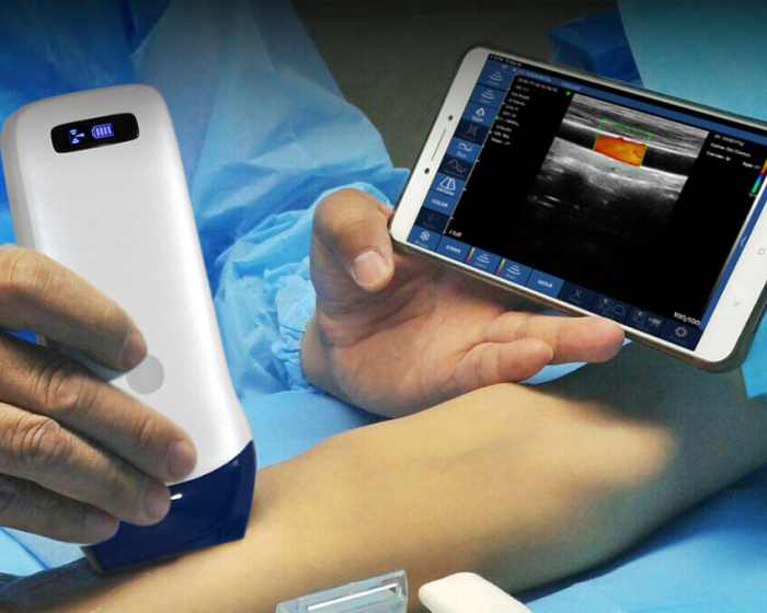 Primary Care Ultrasound
