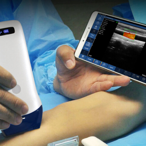 Primary Care Ultrasound