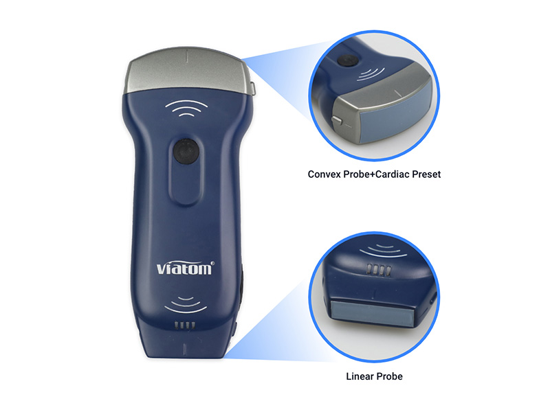 128 Elements Dual-Probes Whole Body Portable Ultrasound Scanner